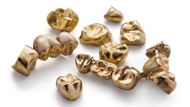 Dentalgold